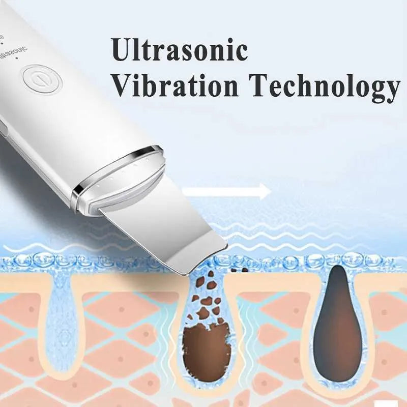 Limpiador Facial Ultrasónico Piel Limpia y Sin Puntos Negros + Envío Gratis